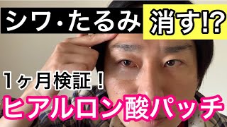 【正直なレビュー】刺すヒアルロン酸…おでこのシワを消す？目の下のクマ•たるみを取る？？【マイクロニードルパッチ】