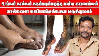 உஷார்! கால்கள் கருப்படிப்பதற்கு முக்கிய காரணங்கள் TOP REASONS FOR BLACKENING OF LEGS |TREATMENT