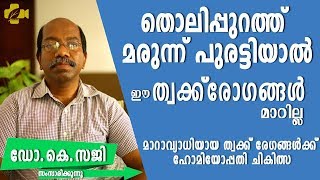 ത്വക്ക് രോഗങ്ങൾ പൂർണ്ണമായും മാറാൻ | treatment for SKIN DISEASE