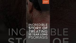 Witness the incredible journey of psoriasis transformation #Psoriasis #Jiva #Ayurveda #successstory