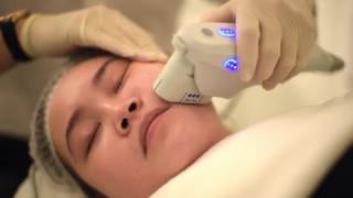 Ultherapy: Treatment, Real-Time Ultrasound, Treatment Depths