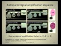 Microfluidics 2.0: Point-of-Care Diagnostics for the Developed and Developing World