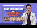 What nose gets successful rhinoplasty?