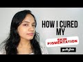 தமிழில் - How I cured my Skin Pigmentation in Tamil✨