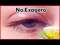 En 10 Minutos Cambiara Todo Como Desinflamar Los Ojos Después De Llorar