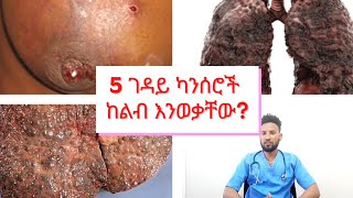 5 ገዳይ የካንሰር ዓይነቶች(የጡት ካንሰር)(The five fatal cancers in the world)