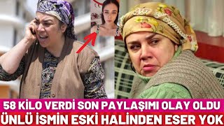 Oyuncu Yeşim Ceren Bozoğlu’nun Son Hali Şaşkınlık Yarattı