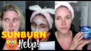 Got a Sunburn? Need HELP! How to get rid of a sunburn QUICK! | Gypsy Wife Life