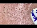 Satisfying Hien Spa Beauty Relaxing Video #14