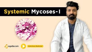 Systemic Mycoses -I | Infectious Medicine | Clinical Video Lectures | Medical V-Learning