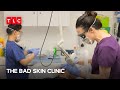 Diabetes-Related Skin Problems | The Bad Skin Clinic S2