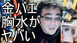 【よっさん】金バエの胸水がヤバい...【肝不全末期 余命1年】2024/05/10