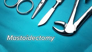 Mastoidectomy