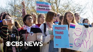 These 20 states have passed bans on gender-affirming care for minors