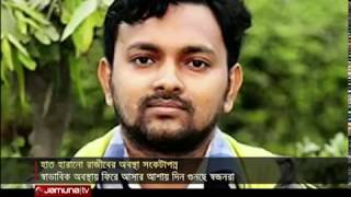 দুই বাসের চাপায় হাত হারানো রাজীবের অবস্থা সংকটাপন্ন | Jamuna TV