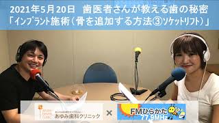 インプラント施術（骨を追加する方法③ソケットリフト）