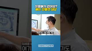 잇몸뼈가 없어도 임플란트 할 수 있는 이유... #잇몸뼈 #뼈이식 #임플란트