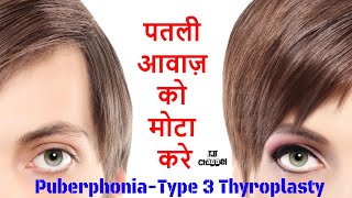 सर्जरी द्वारा अपनी पतली आवाज कैसे बदलें? Thyroplasty for Puberphonia after failed speech therapy.