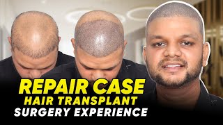 Hair Transplant in Salem | Best Results & Cost of Hair Transplant in Salem