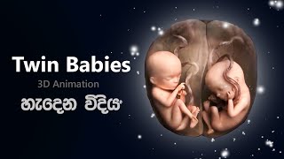 නිවුන් දරුවන් කොහොමද හැදෙන්නෙ 😨| Development of Twins in sinhala | twin babies | niwun daru upath