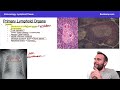 1 free usmle step 1 immunology course 12 hour review med school bootcamp