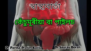 কেঁচুমূৰীয়া বা পাইলচ।। PILES ।। ASSAMESE VERSION  ।। স্বাস্থ্যবাৰ্তা