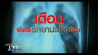 เจาะข่าวเด่น | เตือนฝังแร่รักษามะเร็งที่จีน | 23-04-58