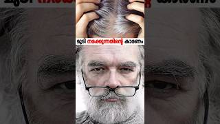 ഇതായിരുന്നു മുടി നരക്കാനുള്ള കാരണം ||  Scientists may have discovered why hair turns grey #shorts