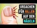 Die WAHREN Ursachen für vertikale Rillen auf deinen Nägeln!