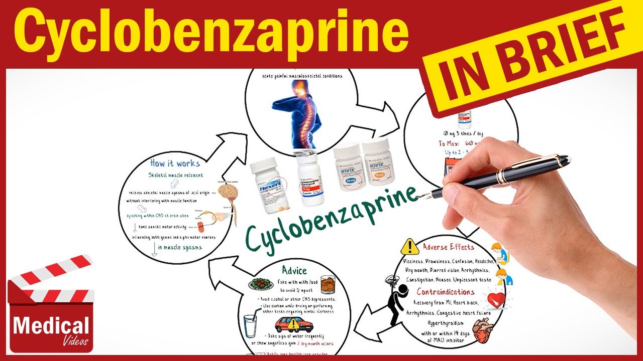 Cyclobenzaprine 10mg ( Flexeril ): What Is Cyclobenzaprine? Flexeril ...