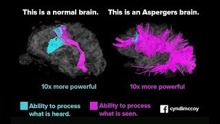 The Autistic Brain & Visual Thinking Part II - My own experience