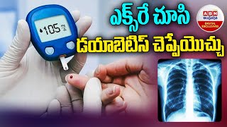 X-ray Checkup : ఎక్స్ రే చూసి మధుమేహం,డయాబెటిస్‌ వచ్చేఅవకాశాలను చెప్పేయొచ్చు!| ABN DigitalExclusives