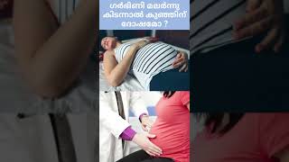 ഗർഭിണി മലർന്ന് കിടന്നാൽ കുഞ്ഞിന് ദോഷമോ? 💯#shorts #youtube #viral #normaldelivery  #subscribe