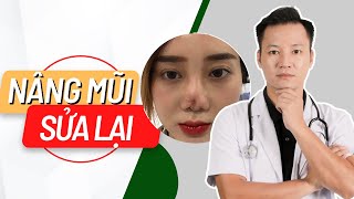 Phương pháp nâng mũi sửa lại hiệu quả nhất | Bác sĩ Trọng