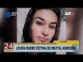 Mujer fue agredida en Ypacaraí