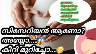 c-section complications||സിസേറിയൻ ഉണ്ടാവുന്ന പ്രശ്‌നങ്ങൾ ഇത്ര വലുതോ..?