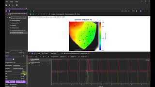 Data Analysis using BV Workbench - 4-1. Activation map