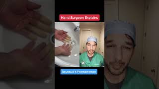 Hand surgeon Nick Pappas MD (Metairie, LA) discusses Raynaud’s phenomenon #Raynauds #Finger #Medical