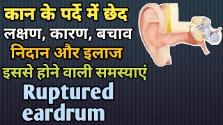 कान के पर्दे में छेद होने के लक्षण, कारण और इलाज || Ruptured eardrum in Hindi || MedHealth Support