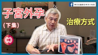 【幸孕小角落】醫師談談子宮外孕的治療? 優缺點為何?(下集)