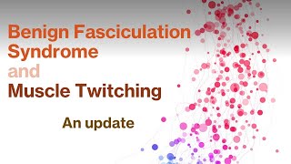 Benign fasciculation syndrome and muscle twitching (an update)