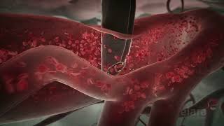 Malaria 3D Animation Shows How the Infection Spreads in the Body