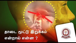 தாடை மூட்டு இறுக்கம் என்றால் என்ன ?  TMJ Ankylosis ( Tamil )  with Dr. Kirubavathy