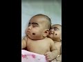 beautiful smile of twins baby at sleeping time ഉറങ്ങുന്ന സമയത്ത് ഇരട്ടക്കുട്ടിയുടെ മനോഹരമായ പുഞ്ചിരി