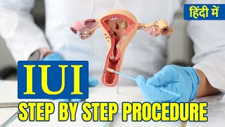 ⭐IUI (आईयूआई) कैसे होता है? | IUI Procedure Step by Step in Hindi | Do And Don't after IUI Treatment