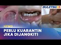 HFMD | Jaga Kebersihan Diri Dan Persekitaran