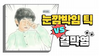 눈 깜빡임 틱? 결막염? 헷갈릴 때 구별하는 방법