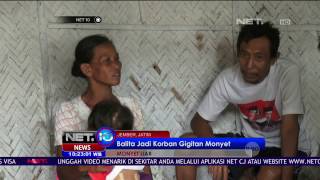 Balita Jadi Korban Gigitan Monyet Liar - NET10