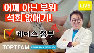 어깨 아닌 부위 석회 없애기! (케이스 리뷰) #탑팀재활의학과