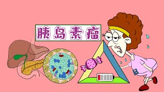 医学记忆漫画 | 终于弄懂反复低血糖病因【胰岛素瘤】和 Whipple三联征